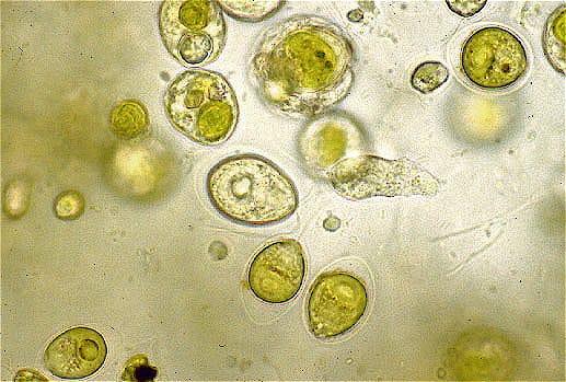 Bacteria in Drinking Water - US Water Systems