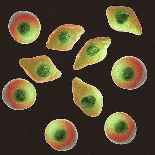 How Much Cryptosporidium do you Like in Your Water? - US Water Systems