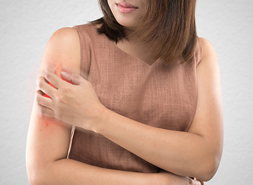 Water Can Cause Eczema Problems With Skin and Hair